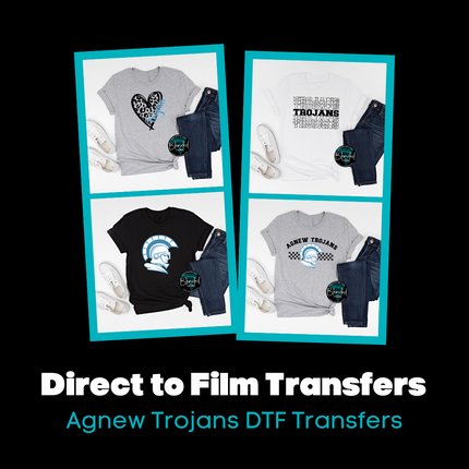 Collection image for: Agnew Direct to Film Stock Transfers